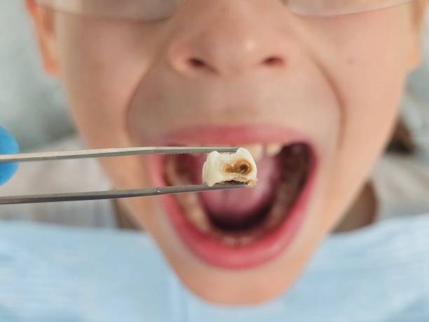 Best Emergency Treatment for Jaw Pain or Injury in Fish Hawk, FL